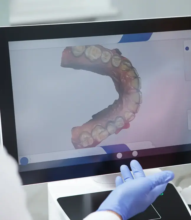 zobārsts analizē 3D zobu skenējumu personālizētu kapju veidošanai