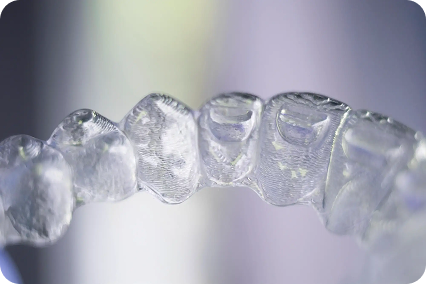 Kapes zobu taisnošanai tuvplānā, redzamas formas priekšzobiem