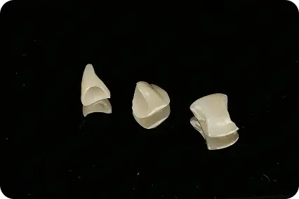 Trīs zobu kroņi uz melna fona, dažādas formas un izmēri