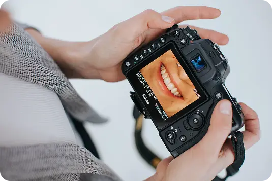 Zobu fotografēšana ar kameru, lai fiksētu smaida izmaiņas pēc ārstēšanas