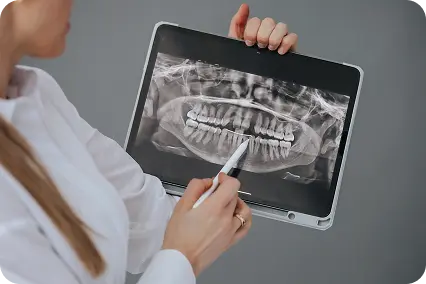 Zobārste rāda panorāmas zobu rentgenu planšetē