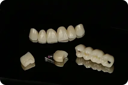 Zobu protēzēšanas elementi uz melna fona, kroņi, tilts un implanta savienotāji