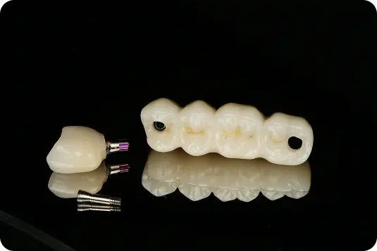 Implantu balstīts zobu tilts un atsevišķs kronis ar skrūvju balstiem uz melna fona