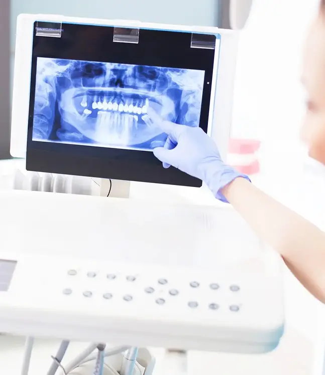 Zobu rentgens ekrānā, ārsts norāda uz problemātisku zobu