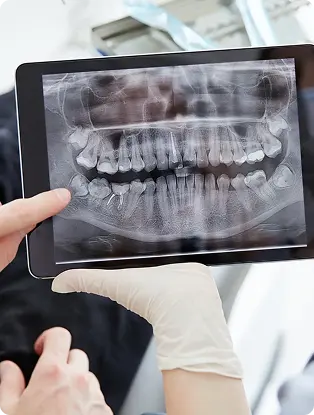 Speciālists rāda pacientam panorāmas zobu rentgenu planšetē, ar pirkstu izceļ slikti ieaugušu zobu